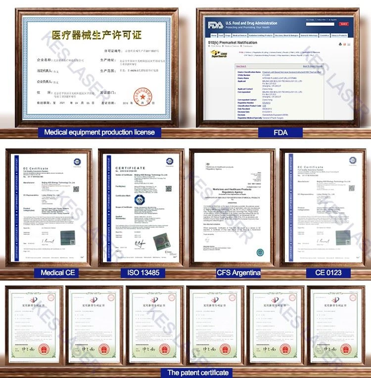 diode laser hair removal equipment
