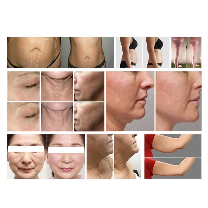 Vacuum Body Slimming Beauty Machine